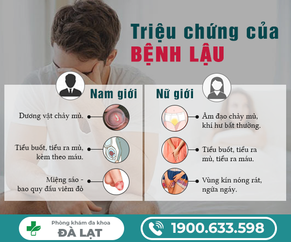 Hình ảnh minh họa